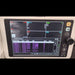 Philips SURESIGNS VS4 Vital Signs - used medical equipment - image 2